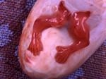 Ребёнок, убитый абортом на 7-й неделе