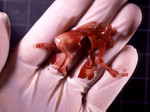 Ребёнок, убитый абортом на 11-й неделе