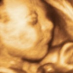 baby boy ultrasound 620x250 - Защита нерожденных детей в Мексике