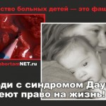sinddauna - Всемирный день людей с синдромом Дауна отметили в Санкт-Петербурге